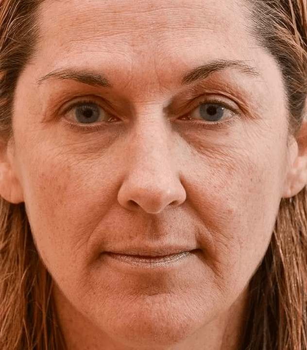 Mein Gesicht vor der Verwendung der Eudalie -Creme