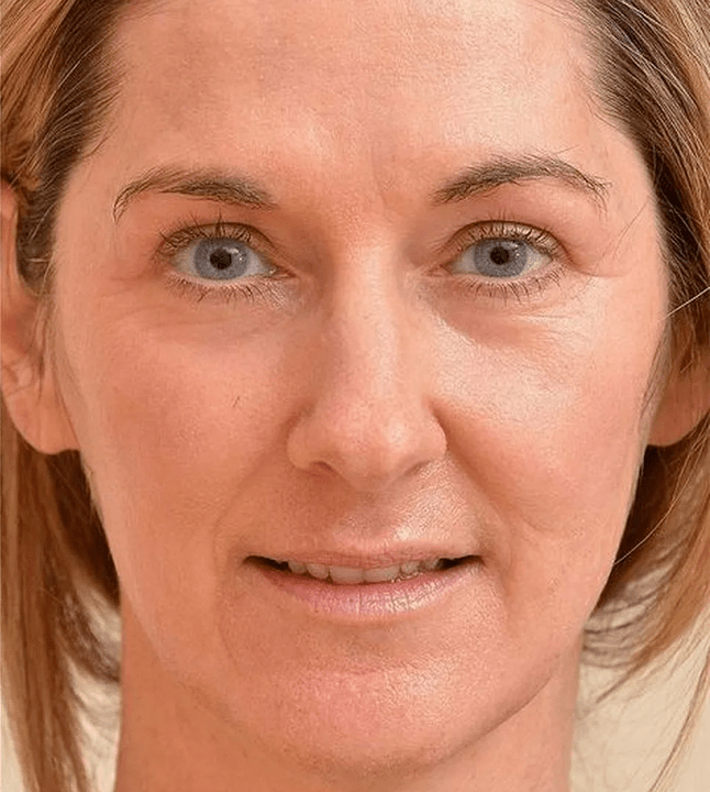 Sie sehen jünger aus, nachdem Sie die Eudalie -Creme verwendet haben