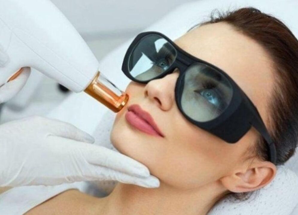 Hautverjüngung der Haut